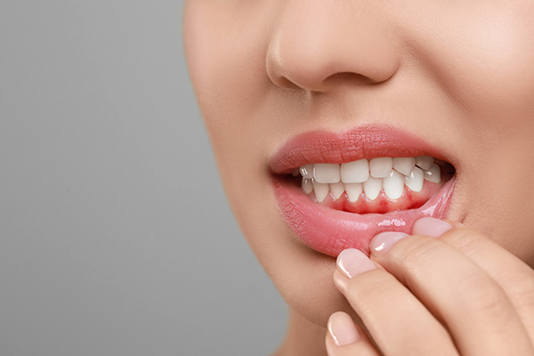The image features a close-up of a person's face with a focus on their teeth and lips, where they appear to be biting their lip.