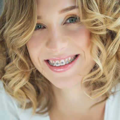 A woman with straightened teeth, brunette hair, wearing a white top, smiling at the camera.
