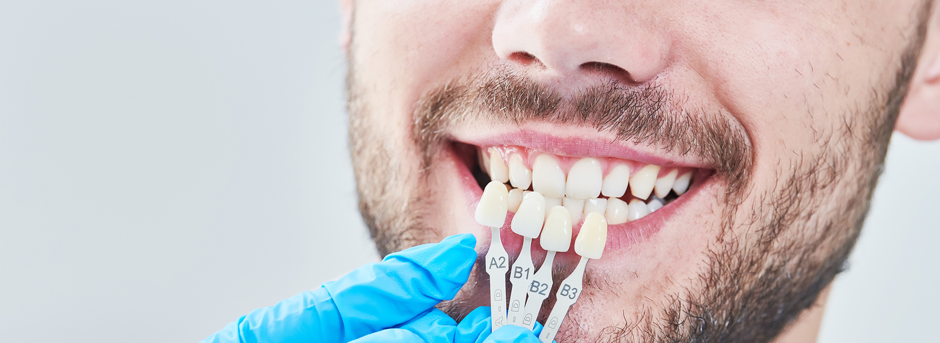 The image shows a man with a toothy smile undergoing dental treatment, with visible dental instruments and a blue surgical gown.